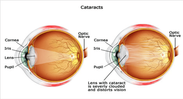 Picture Opticianworks Online Optician Training